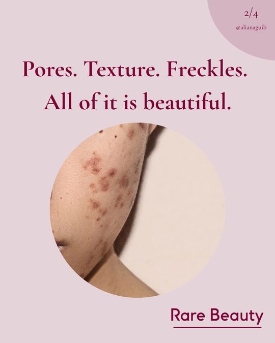 Slide 2: Pores. Texture. Freckles. All of it is beautiful.